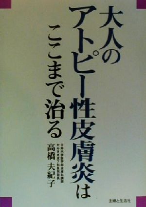 大人のアトピー性皮膚炎はここまで治る 高橋 夫紀子