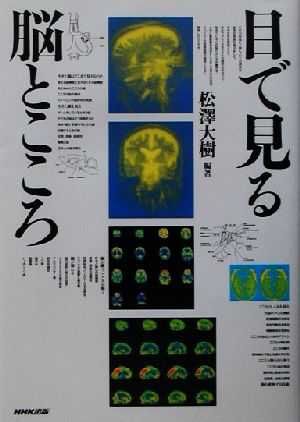 目で見る脳とこころ [Feb 01， 2003] 松澤 大樹