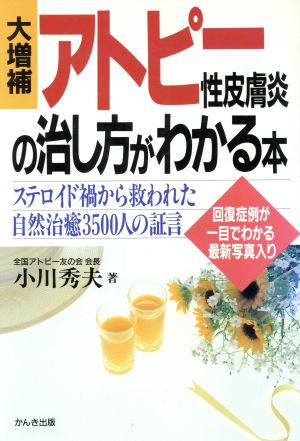 アトピー性皮膚炎の治し方がわかる本 大増補 [Mar 01， 1994] 小川 秀夫
