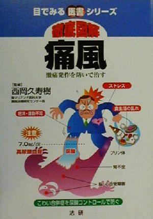 徹底図解痛風: 激痛発作を防いで治す (目でみる医書シリーズ) 西岡久寿樹