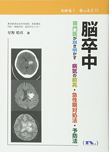脳卒中─専門医が説き明かす 病気の前兆・急性期対処法・予防法 (わかる! なっとく!!) [単行本] [Jul 28， 2017] 星野晴彦
